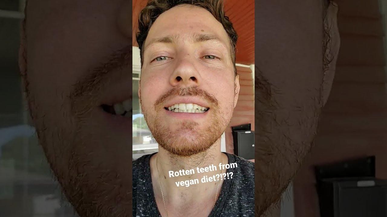 Зъбите ми се развалят 🥰